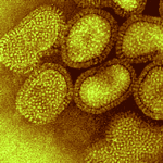 diseases